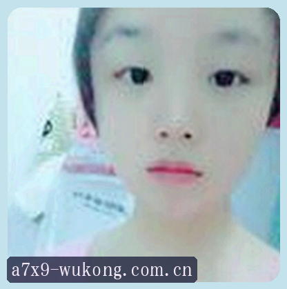黄丽
